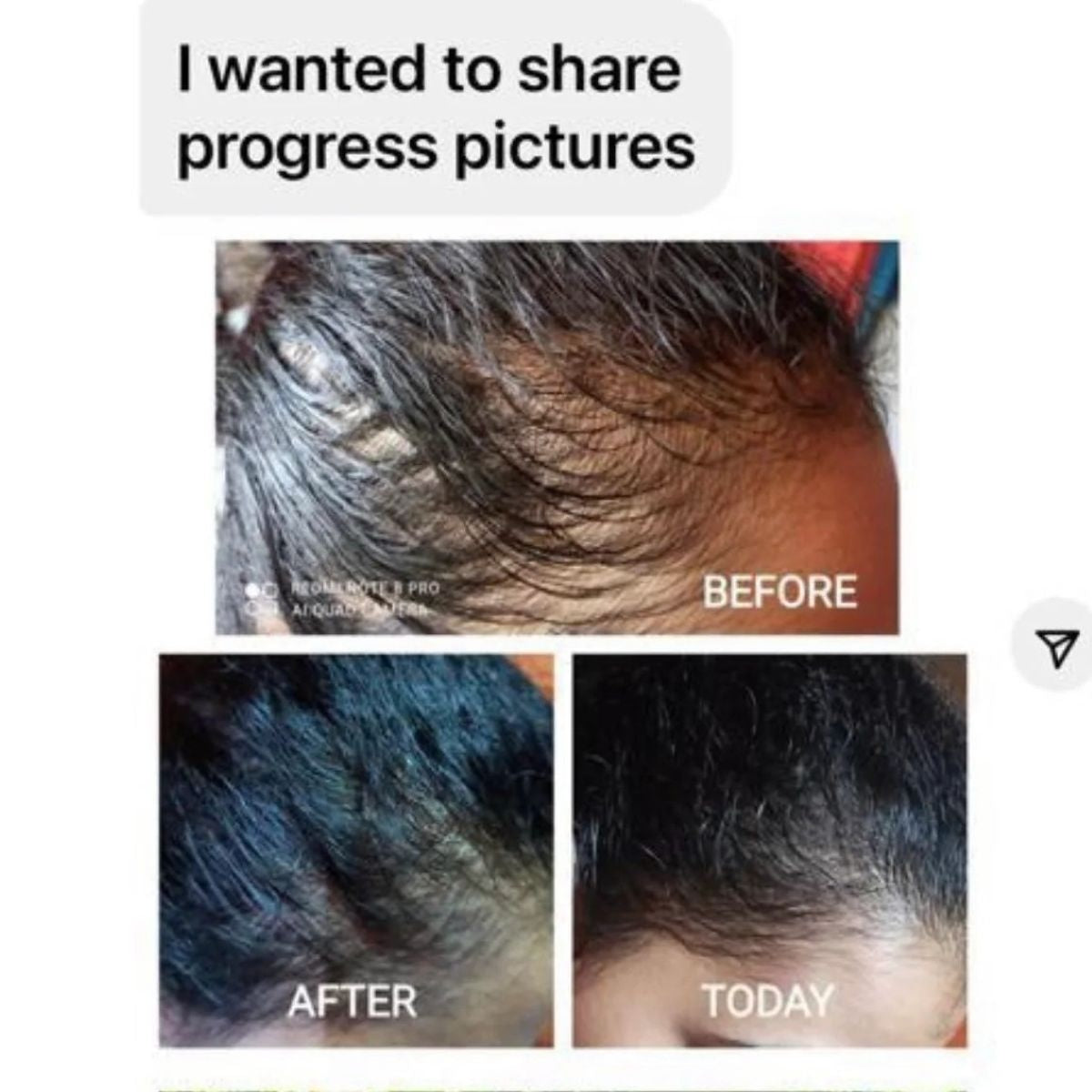 Rosemary Hydrosol Hair Growth Spray | 50ml