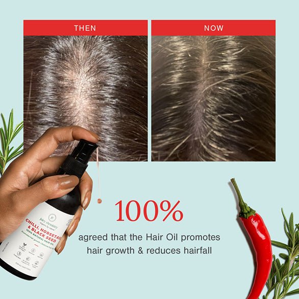 Chilli, Horsetail & Blackseed Hair Oil - 30 ml | Natural Hair Growth Oil | Verified Sustainable by Brown Living™