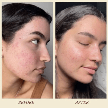 Skin Transformative Night Essentials – Skin Care on Brown Living™. SKU: ORG - NOOR - KAYA - COMBO. Img 6.