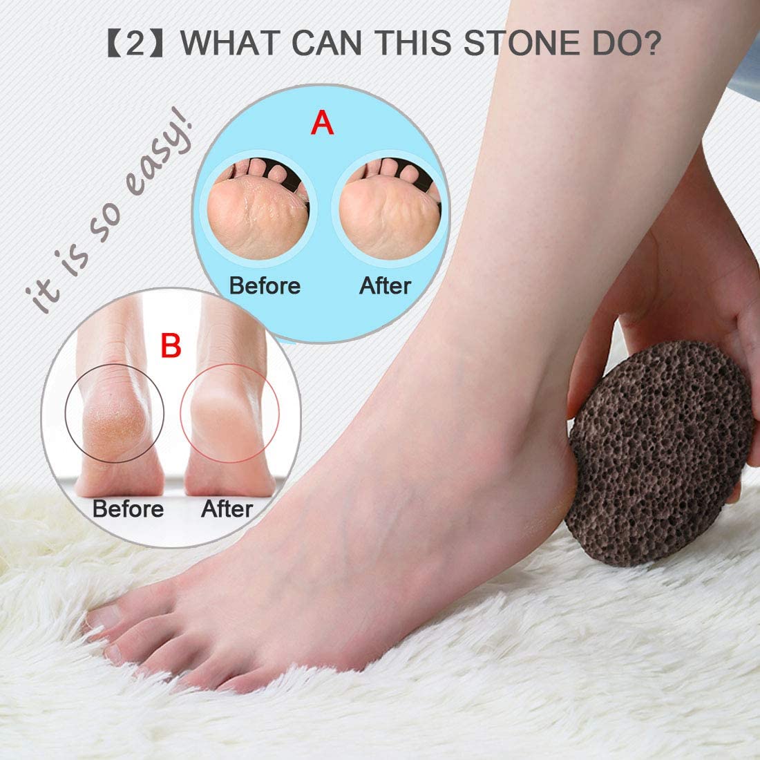 Volcanic Lava Pumice Stone Foot and Hand Skin Pedicure Callus Dead Skin Remover | Pedicure Tool Exfoliation to Remove Dead Skin | Verified Sustainable by Brown Living™